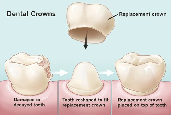 Crown
