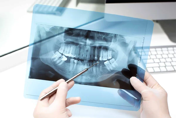 X-Ray