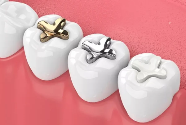 Sealants